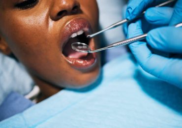 teeth-cleanig